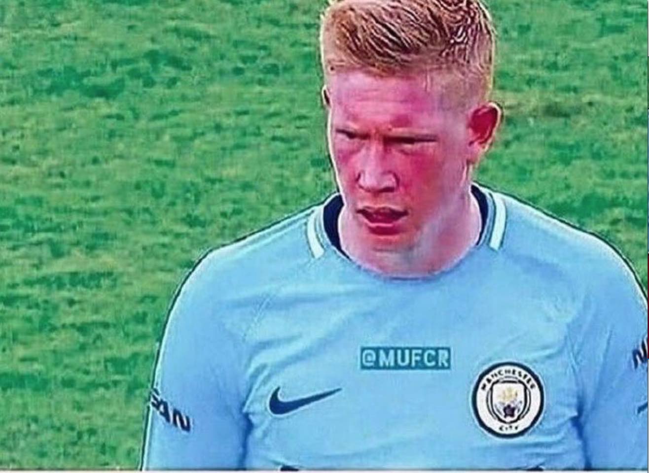 西媒：阿诺德和卡马文加今天接受检查，二人伤情都令人担忧